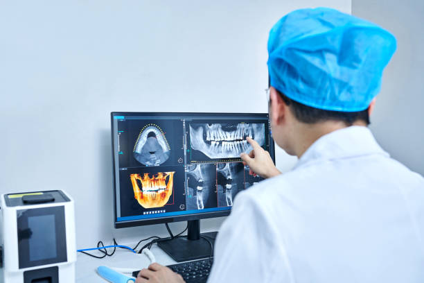 Best Emergency Dental Care for Broken or Chipped Teeth in St Cloud, FL